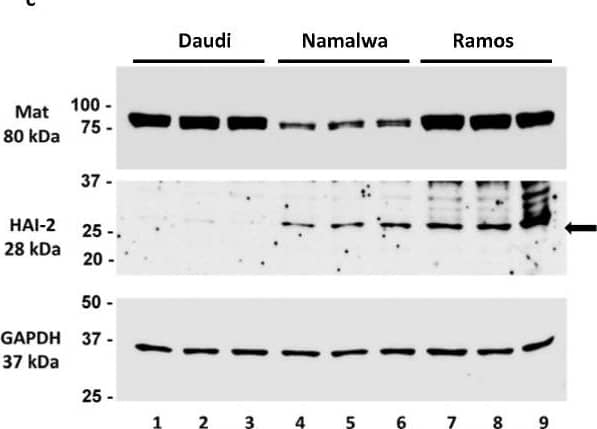 Western Blot HAI-2/SPINT2 Antibody