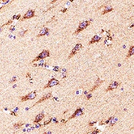 Dkk‑3 was detected in immersion fixed paraffin-embedded sections of Human Brain Hippocampus using Goat Anti-Human Dkk‑3 Antigen Affinity-purified Polyclonal Antibody (Catalog # AF1118) at 3 &micro;g/mL for 1 hour at room temperature followed by incubation with the Anti-Goat IgG VisUCyte&trade; HRP Polymer Antibody (Catalog # VC004). Before incubation with the primary antibody, tissue was subjected to heat-induced epitope retrieval using VisUCyte Antigen Retrieval Reagent-Basic (Catalog # VCTS021). Tissue was stained using DAB (brown) and counterstained with hematoxylin (blue). Specific staining was localized to cytoplasm in neurons. View our protocol for IHC Staining with VisUCyte HRP Polymer Detection Reagents.