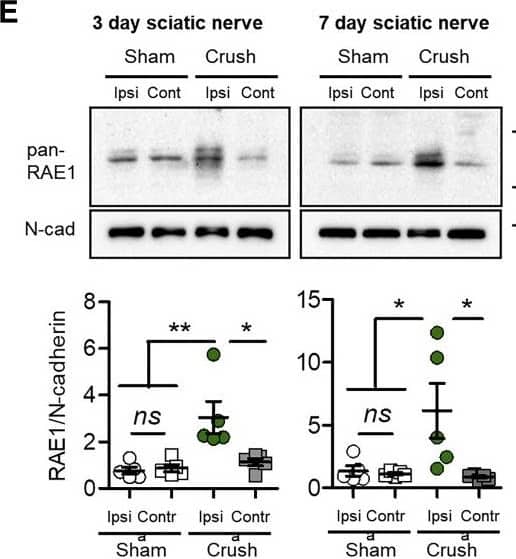 Sciatic Nerve Crush Increases RAE1 in Peripheral Nerve Axons(A) Schematic diagram of sciatic nerve crush injury site in relation to lumbar DRGs (L3, L4, and L5).(B) Raet1 mRNA expression in ipsilateral L3–5 DRG 3 and 7 days after surgery by qPCR. Two-way ANOVA: effect of injury, F(1,8) = 180.95, p < 0.0001; effect of time, F(1,8) = 8.04, p = 0.0220. Bonferroni post-test: 3 days, t = 7.507, ∗∗∗p < 0.001; 7 days, t = 11.52, ∗∗∗p < 0.001. n = 3 mice per surgery per time point.(C) In situ hybridization with Raet1 probe (red) in L4 DRG immunolabeled for NeuN (blue) 6 days after partial sciatic nerve crush injury. Scale bar, 50 μm.(D) Distribution of Raet1 in situ spots in L4 DRG ipsi and contralateral to sciatic crush. Kolmogorov-Smirnov (KS) test: ∗∗∗p < 0.0001, KS D-value 0.2297. n = 3 mice, n = 3 sections per ipsi and contralateral DRG per mouse.(E) (Top) Pan-RAE1 western blot of sciatic nerve tissue (40 μg protein loading) 3 days after sciatic nerve crush or sham surgery. Neuronal cadherin control is shown. (Bottom) Relative expression of RAE1 protein in ipsilateral versus contralateral sciatic nerves 3 and 7 days after sham or crush surgery. One-way ANOVA, 3 days: F(3,16) = 8.505, p = 0.0013. Bonferroni post-test: sham ipsi versus contra, t = 0.2025, ns p > 0.05; crush ipsi versus contra, t = 3.678, ∗p < 0.05; ipsi sham versus crush, t = 4.438, ∗∗p < 0.01. One-way ANOVA, 7 days: F(3,16) = 5.119, p = 0.0113. Bonferroni post-test: sham ipsi versus contra, t = 0.1438, ns p > 0.05; crush ipsi versus contra, t = 3.342, ∗p < 0.05; ipsi sham versus crush, t = 3.043, ∗p < 0.05 (n = 5 mice per surgery group per time point).(F) (Top) Pan-RAE1 western blot of DRG (L3–5) tissue (40 μg protein loading) 3 days after sciatic nerve crush or sham surgery. Neuronal cadherin control. (Bottom) Relative expression of RAE1 protein in ipsilateral versus contralateral DRG 3 and 7 days after sham or crush surgery. One-way ANOVA: 3 days, F(3,16) = 0.438, p = 0.7288; 7 days, F(3,20) = 0.053, 