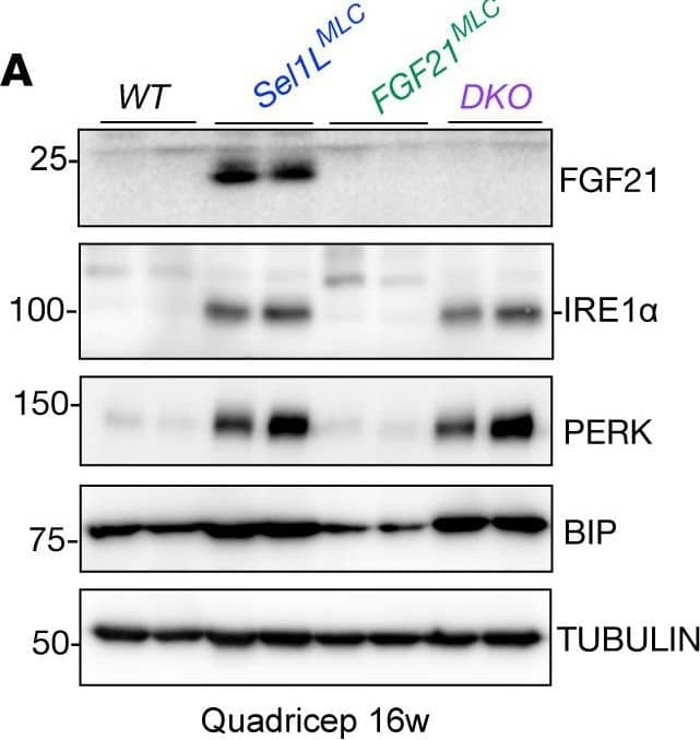 Increased cellular stress response in muscle of DTG mice.(A) Gene expression analysis of FGF21 in Quadriceps muscle by quantitative RT-PCR (n = 8 per group) and (B) FGF21 plasma concentration of 12-wk-old WT, DN-AMPK alpha 2, UCP1-TG and DTG mice (n = 9–10 per group). (B) Representative western blots of proteins involved in integrated stress response and FGF21 induction and (C) of cellular stress response markers HSP25 and HSP70 in Quadriceps muscle from 12-wk-old WT, DN-AMPK alpha 2, UCP1-TG and DTG mice, Mitofusin-2 (MFN2) was used as a loading control (n = 2 out of 6–8 analyzed per group). Means with different letters are significantly different (1way ANOVA and Bonferroni's multiple comparisons test, p 0.05; *P  0.05; *P < 0.05; **P < 0.01; ****P < 0.0001 determined by 1-way ANOVA with Tukey’s multiple-comparison test (B, C, and E) or mixed-effects analysis (repeated-measure ANOVA) with Tukey’s multiple-comparison test (D). Image collected and cropped by CiteAb from the following open publication (//pubmed.ncbi.nlm.nih.gov/37535424), licensed under a CC-BY license. Not internally tested by R&D Systems.