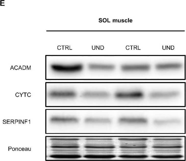 Western blot verification of selected muscle proteins commonly regulated by UND in both the PL and SOL muscles. (A,E) Representative western blot images and densitometric analysis of (B,F)  beta -oxidation enzyme ACADM, (C,G) oxidative phosphorylation enzyme CYTC, and (D,H) glycoprotein SERPINF1 levels in PL and SOL muscles from UND vs. CTRL rats (n = 6/group). Results are expressed as means ± SEM. Unpaired student’s t-test was performed to test the effect of undernutrition (*, P < 0.05; **, P < 0.01). Image collected and cropped by CiteAb from the following open publication (//pubmed.ncbi.nlm.nih.gov/35563153), licensed under a CC-BY license. Not internally tested by R&D Systems.