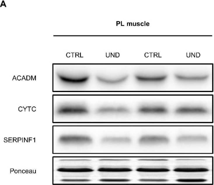Western blot verification of selected muscle proteins commonly regulated by UND in both the PL and SOL muscles. (A,E) Representative western blot images and densitometric analysis of (B,F)  beta -oxidation enzyme ACADM, (C,G) oxidative phosphorylation enzyme CYTC, and (D,H) glycoprotein SERPINF1 levels in PL and SOL muscles from UND vs. CTRL rats (n = 6/group). Results are expressed as means ± SEM. Unpaired student’s t-test was performed to test the effect of undernutrition (*, P < 0.05; **, P < 0.01). Image collected and cropped by CiteAb from the following open publication (//pubmed.ncbi.nlm.nih.gov/35563153), licensed under a CC-BY license. Not internally tested by R&D Systems.