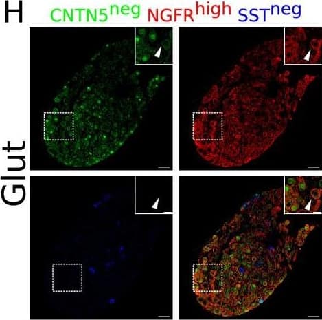 Immunohistochemistry validation of bilateral stellate ganglion neuronal subtypes identified from scRNAseq data analysis. Except NA2 and Glut, all other neuronal subtypes express either high or low Npy. NA1a, NA1b, NA1c neurons appeared numerically more compared to the NA2, NA3, ACh1, ACh2, and Glut. (A) NA1a neuronal subtypes in the stellate ganglia. NA1a neurons express high Cntn5 and Npy (Inset) and can be easily distinguished from the low Npy expressing neurons co-labeled with Cntn5high. (B) Stellate section contains neurons that stained for Kcnt1 and express either low or high Npy but the NA1b subtype can be distinguished by low Npy and high Kcnt1 expression (inset). (C) NA1c subtype similar to NA1b contains low Npy but higher Sctr labeled on the cell borders (inset). (D) NA2 neurons are differentiated from the Glut with expression of high Calm1 and low Ngfr while Glut neuronal subtype expresses low Calm1 and high Ngfr. (E) NA3 subtype can be separated from ACh1 based on low Npy and high Vimentin gene expression whereas ACh1 (F); express high Npy and low Vimentin. (G) ACh2 subtype was separated from others with low Npy and high Vip expression. (H) Gluts expressed high Ngfr expression and are negative for Cntn5 and Sst. In insets, all subtypes are marked for each group and their magnified view is shown in the upper right corner of the figure. n=6. Scale bars 50 and 20 µm. Image collected and cropped by CiteAb from the following open publication (//pubmed.ncbi.nlm.nih.gov/37162194), licensed under a CC-BY license. Not internally tested by R&D Systems.