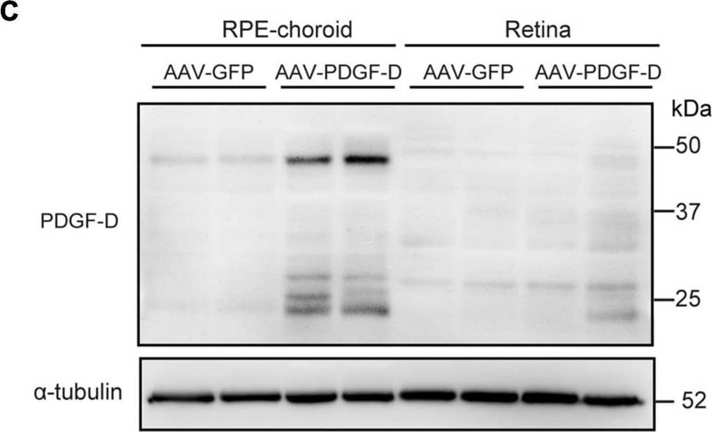 RPE-specific overexpression of PDGF-D in vivo.(A) Schematic diagram illustrating the AAV vector carrying GFP (AAV-GFP) or human PDGF-D (AAV-PDGF-D) gene and RPE specific VDM2 promoter. (B) Real-time PCR results of relative mRNA expression of PDGF-D in retinae or RPE-choroid complex from mice injected with AAV-GFP or AAV-PDGF- D for 4 weeks. (C) Representative immunoblotting showing PDGF-D expression in mouse retinae or RPE-choroid complex. (D) Quantifications of PDGF-D protein levels in (C). (E) Immunofluorescence images highlighting RPE-specific expression of GFP or PDGF-D in mouse RPE-choroid complex with 4 weeks AAV-GFP or AAV-PDGF-D injection, respectively. Scale bar: 50 μm. n = 5, ****p < 0.0001, ns: not significant. Image collected and cropped by CiteAb from the following open publication (//pubmed.ncbi.nlm.nih.gov/34150781), licensed under a CC-BY license. Not internally tested by R&D Systems.