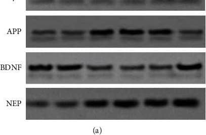 Effects of A beta 1-42 and Nav beta 2 on APP, BDNF, and NEP in A beta 1-42-treated mice. (a) Representative blots of Nav beta 2, APP, BDNF, NEP, and GAPDH in mice with various treatments indicated by Western blot assay. (b–e) Quantitative plots of Nav beta 2, APP, BDNF, and NEP in hippocampus of mice from different groups. (f) Quantitative image of NEP enzymatic activity between each experimental group. Intragroup sample size n = 7. ∗Versus two different treatment groups, P  0.05. Empty: empty viral vector; OE: overexpression; si: small interfering. Image collected and cropped by CiteAb from the following open publication (//pubmed.ncbi.nlm.nih.gov/36406589), licensed under a CC-BY license. Not internally tested by R&D Systems.