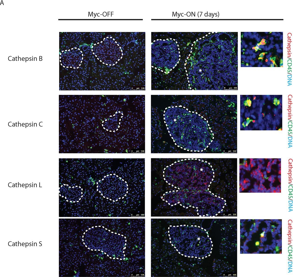 Myc induces cathepsin L expression in beta-cells of pancreatic Islets.(A) Immunohistochemical analyses for CTS B, C, L or S expression (all in red) in combination with staining for the pan-leukocyte marker CD45 (green) in pancreatic islet tumors from the MycERTAM;Bcl-xL animals. Pancreata were harvested from the MycERTAM;Bcl-xL mice treated for 7 d with TAM (Myc-On, 7 days) or control vehicle in place of TAM (Myc-OFF). The islet area is indicated by dotted line. The asterisks indicate the area of tumor represented in the insets. The panels are representatives of at least three animals assayed at each data point, all immunohistochemical analyses were done in duplicate; eight randomized fields per analysis were examined. Scale bars, 100μm. (B) Immunohistochemical analysis for cathepsin L expression in beta-cells of pancreatic islets from MycERTAM;Bcl-xL animals identified by insulin expression. Pancreata were collected from the animals described above. Scale bars represent 25μm. The panels are representatives of three animals assayed at each data point, all immunohistochemical analyses were done in duplicate; ten randomized fields per analysis were examined. Image collected and cropped by CiteAb from the following open publication (//dx.plos.org/10.1371/journal.pone.0120348), licensed under a CC-BY license. Not internally tested by R&D Systems.