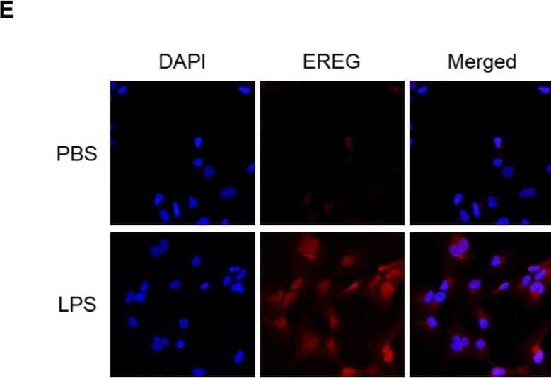 Immunocytochemistry/ Immunofluorescence Epiregulin Antibody [Unconjugated]