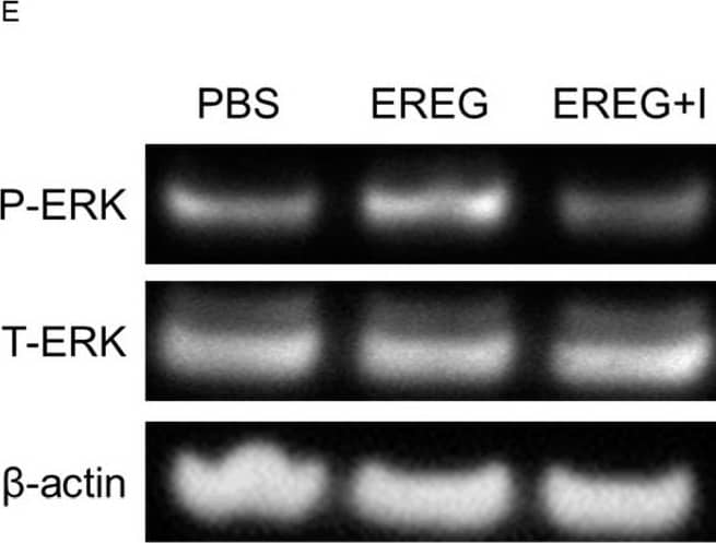 Western Blot Epiregulin Antibody [Unconjugated]