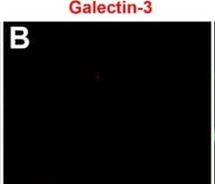 Immunocytochemistry/ Immunofluorescence Galectin-3 Antibody [Unconjugated]