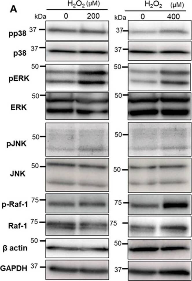 Evaluation of the phosphorylation of MAPK family members and Raf-1 in Bag-1-overexpressing NP cells. Western blot analysis (A) and quantification (B,C) of the phosphorylated forms of p38, ERK, JNK, and Raf-1 in NP cells treated with or without H2O2 for 30 min. Data are the means ± SD n = 3, * p < 0.05. (D) Comparison of the expression of pERK in NP cells (NP) and Bag-1-overexpressing NP cells (Bag) without H2O2 treatment. Data are the means ± SD n = 3, * p < 0.05. Image collected and cropped by CiteAb from the following open publication (//www.mdpi.com/2227-9059/11/3/863), licensed under a CC-BY license. Not internally tested by R&D Systems.