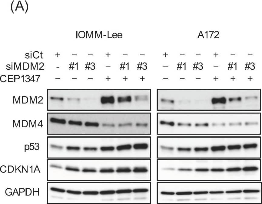 CEP-1347-induced MDM2 overexpression counteracts the CEP-1347-induced activation of p53. IOMM-Lee and A172 cells were transiently transfected with the indicated siRNA against MDM2 (#1 and #3) or with control siRNA (siCt). After being cultured for 1 day, cells treated without or with 250 nM CEP-1347 for 2 and 3 additional days were subjected to a Western blot analysis (A) and the trypan blue dye exclusion assay (B), respectively. Values represent the means + SD of triplicate samples of a representative experiment. * p < 0.05. † p < 0.05 vs. siCt-transfected cells treated without CEP-1347. Similar results were obtained from more than three independent biological replicates. Original blot images can be found in Figure S3. Image collected and cropped by CiteAb from the following open publication (//pubmed.ncbi.nlm.nih.gov/37686602), licensed under a CC-BY license. Not internally tested by R&D Systems.