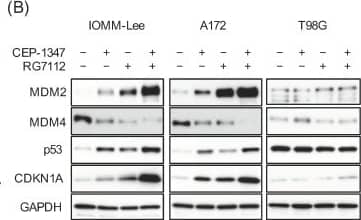 The MDM2 antagonist RG7112 concomitant with CEP-1347 effectively activates p53 and inhibits the growth of malignant brain tumor cells expressing wild-type p53. (A) IMR90 normal human fibroblasts, IOMM-Lee cells, and A172 cells treated with the indicated drugs (CEP-1347, 250 nM; RG7112, 500 nM) for 3 days were subjected to the trypan blue dye exclusion assay. (B) IOMM-Lee, A172, and T98G cells treated with the indicated drugs (CEP-1347, 250 nM; RG7112, 500 nM) for 2 days were subjected to a Western blot analysis. (C) Cells treated with the indicated drugs (CEP-1347, 250 nM; RG7112, 500 nM) for 3 days were cultured for another 5 days in the absence of any drugs for the colony formation assay. Representative images (left panels) and the number of colonies (right graphs) are shown. Values represent means + SD from triplicate samples of a representative experiment. * p < 0.05. † p < 0.05 vs. cells treated without any drugs. Similar results were obtained from more than two independent biological replicates. Original blot images can be found in Figure S4. Image collected and cropped by CiteAb from the following open publication (//pubmed.ncbi.nlm.nih.gov/37686602), licensed under a CC-BY license. Not internally tested by R&D Systems.