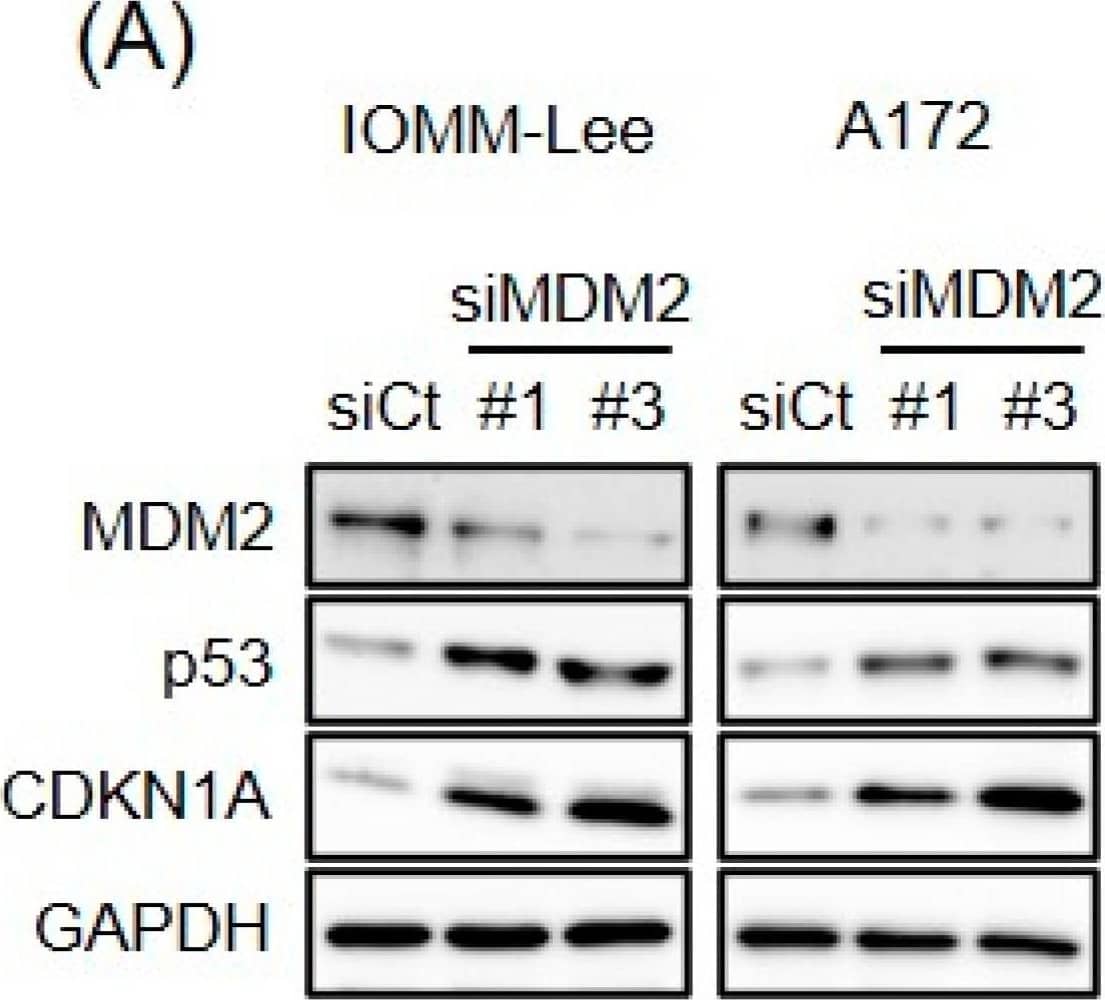 Endogenous expression of MDM2 contributes to p53 inactivation. (A) IOMM-Lee and A172 cells were transiently transfected with the indicated siRNA against MDM2 (#1 and #3) or with control siRNA (siCt). After being cultured for 3 days, cells were subjected to a Western blot analysis. (B) Cells were transiently transfected as in (A). After 3 days, transfected cells were subjected to the trypan blue dye exclusion assay to measure the number of viable cells. Values represent means + SD from triplicate samples of a representative experiment. * p < 0.05 vs. siCt-transfected cells. Similar results were obtained from more than two independent biological replicates. Original blot images can be found in Figure S2. Image collected and cropped by CiteAb from the following open publication (//pubmed.ncbi.nlm.nih.gov/37686602), licensed under a CC-BY license. Not internally tested by R&D Systems.