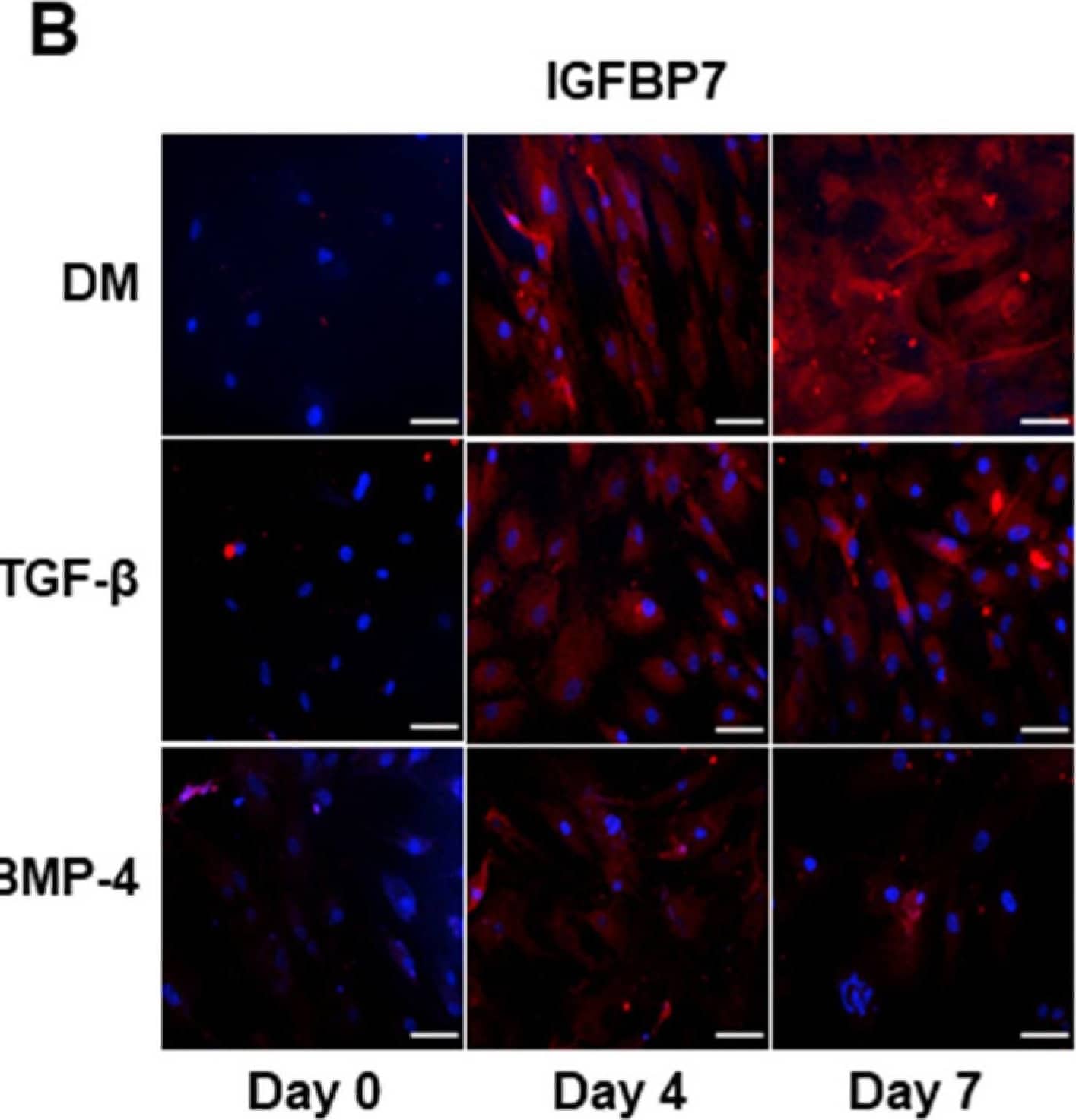IGFBP7 expression is increased in human ASCs going through differentiation with TGF-beta  and BMP-4. (A) Top is representative immunoblot for IGFBP7 expression. Corresponding line graph demonstrating the time-course (0 to 7 days) effect of TGF-beta  and BMP-4 on IGFBP7 expression. TGF-beta  and BMP-4 synergistically induce the expression of IGFBP7 on hASC. hASCs were stimulated with TGF-beta , BMP-4 or combination of TGF-beta  and BMP-4 (DM) for up to 7 days and IGFBP7 expression was evaluated by Western blot. Top are representative immunoblots for IGFBP7 expression. Corresponding bar graph demonstrating the time-course (0 to 7 days) effect of TGF-beta , BMP-4 or DM on IGFBP7 expression. (B) Fluorescence microscopy was also used to detect TGF-beta , BMP-4 or DM-induced IGFBP7 expression on day 0, 4 and 7. Scale bar 100µm. Results are mean ± SEM of 5 experiments. * p < 0.05 vs. day 0 of stimulation with DM; ** p < 0.05 vs. day 0 of stimulation with TGF-beta ; # p < 0.05 vs. day 0 of stimulation with BMP-4. Image collected and cropped by CiteAb from the following open publication (//pubmed.ncbi.nlm.nih.gov/34356861), licensed under a CC-BY license. Not internally tested by R&D Systems.