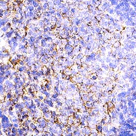 B7‑2/CD86 was detected in immersion fixed paraffin-embedded sections of Rat Spleen using Goat Anti-Rat B7‑2/CD86 Antigen Affinity-purified Polyclonal Antibody (Catalog # AF1340) at 10 &micro;g/mL for 1 hour at room temperature followed by incubation with the Anti-Goat IgG VisUCyte&trade; HRP Polymer Antibody (Catalog # VC004). Before incubation with the primary antibody, tissue was subjected to heat-induced epitope retrieval using VisUCyte Antigen Retrieval Reagent-Basic (Catalog # VCTS021). Tissue was stained using DAB (brown) and counterstained with hematoxylin (blue). Specific staining was localized to cell surface and cytoplasm in splenocytes. View our protocol for IHC Staining with VisUCyte HRP Polymer Detection Reagents.