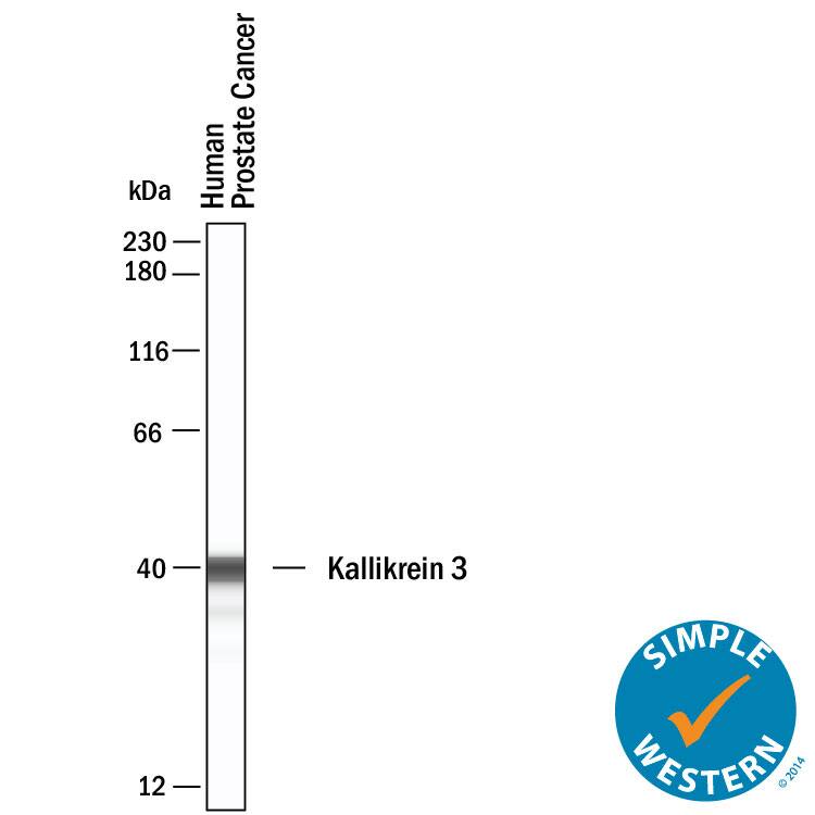 Simple Western lane view shows lysates of human prostate cancer, loaded at 0.2 mg/ml. A specific band was detected for Kallikrein 3/PSA at approximately 40 kDa (as indicated) using 5 µg/ml of Goat Anti-Human Kallikrein 3/PSA Antigen Affinity-purified Polyclonal Antibody (Catalog # AF1344) followed by  HRP-conjugated Donkey Anti-Goat Secondary Antibody (Catalog # 043-522-2). This experiment was conducted under reducing conditions and using the 12-230kDa separation system.