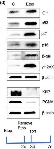 GH is induced in different senescence models & is a SASP component. (a) Oncogene‐induced senescence. WB of hNCC infected with lentivirus‐expressing, constitutively activated mutant V‐12HRAS oncogene (lentiV‐12HRAS) or empty vector (lenti‐CMV) & analyzed 7 days later. (b) DNA damage‐induced senescence. WB of hNCC exposed to indicated doses of UVC light or left untreated (NT) & analyzed 6 days later. (c) Replicative senescence. WB of hNCC passaged until proliferation was significantly reduced.  from Passage 8 (p.8) & Passage 61 (p.61) compared. (d) WB of senescence markers in hNCC treated with DMSO (control) or 50 μM etoposide for 48 h & analyzed 7 days after beginning treatment. (e) Representative images of hNCC treated with DMSO (Control) or with 50 μM etoposide for 48 h & stained for SA‐ beta ‐gal (blue) & GH (brown) 6 days after beginning treatment. Note that only senescent  express GH. Scale bar = 20 μm. (f, g) hNCC infected with lentivirus expressing shScr as control or shGH, treated with 50 μM etoposide (Etop) or DMSO (C) for 48 h, & analyzed 6 days after beginning treatment. (f) WB of cell GH & senescent marker expression. (g) WB of secreted GH in culture medium (in duplicate). EM, empty medium. Medium concentration was equalized according to cell number in wells. Ponceau was used as a loading control. (h) WB of GH & senescence markers & (i) real‐time PCR of GH in human fibroblasts derived from indicated progeroid syndrome patients & healthy volunteers as controls (C). AT, ataxia telangiectasia; CS, Cockayne syndrome; CSB, Cockayne syndrome group B; HGPS, Hutchinson–Gilford progeroid syndrome; XP, xeroderma pigmentosa. ImageJ quantification of WBs is depicted in Figure S1A & S2A,B,D,E. In a–d, f, & g, representative blots from at least three independent experiments are shown. Image collected & cropped by CiteAb from the following open publication (//pubmed.ncbi.nlm.nih.gov/38724466), licensed under a CC-BY license. Not internally tested by R&D Systems.