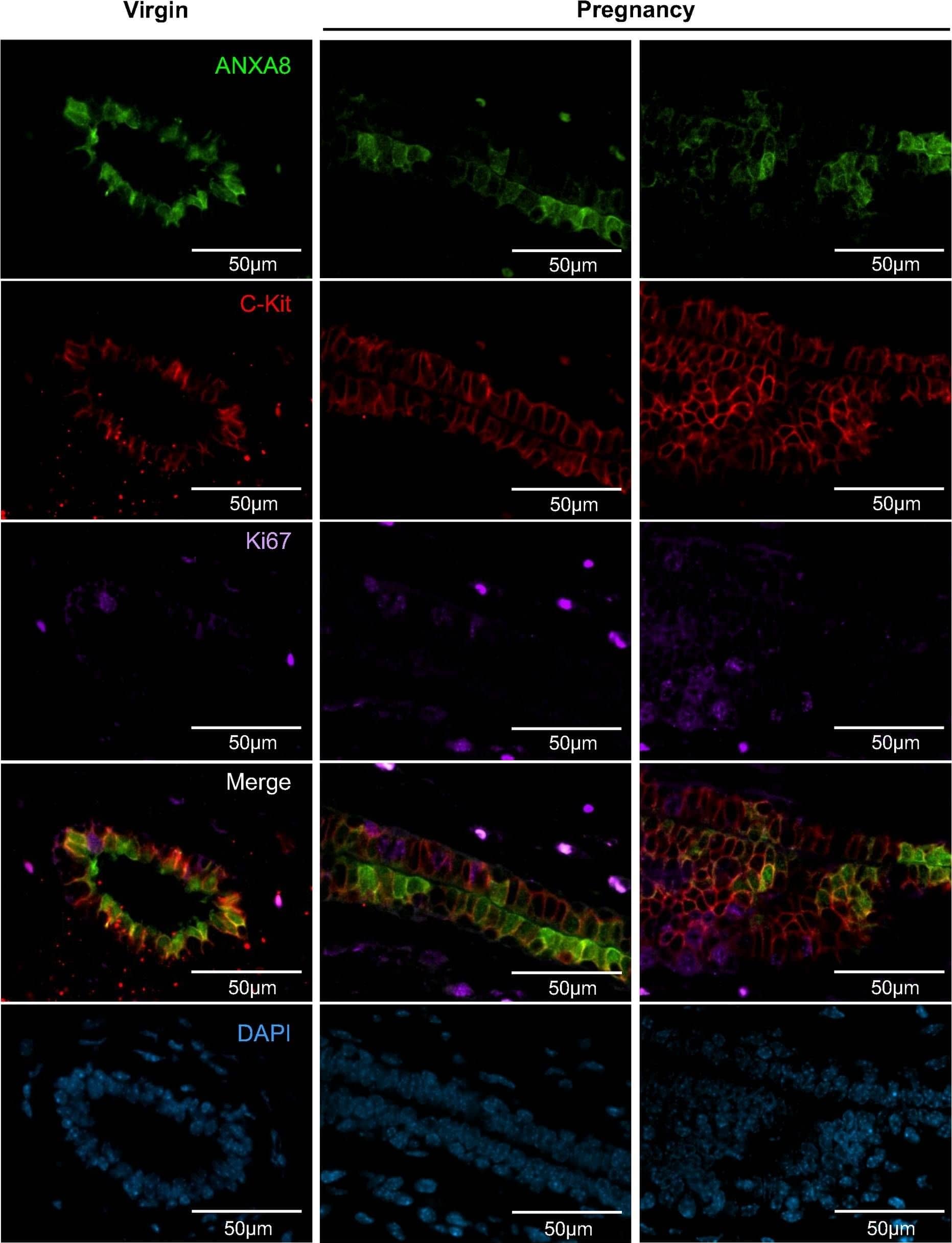Immunocytochemistry/ Immunofluorescence CD117/c-kit Antibody [Unconjugated]