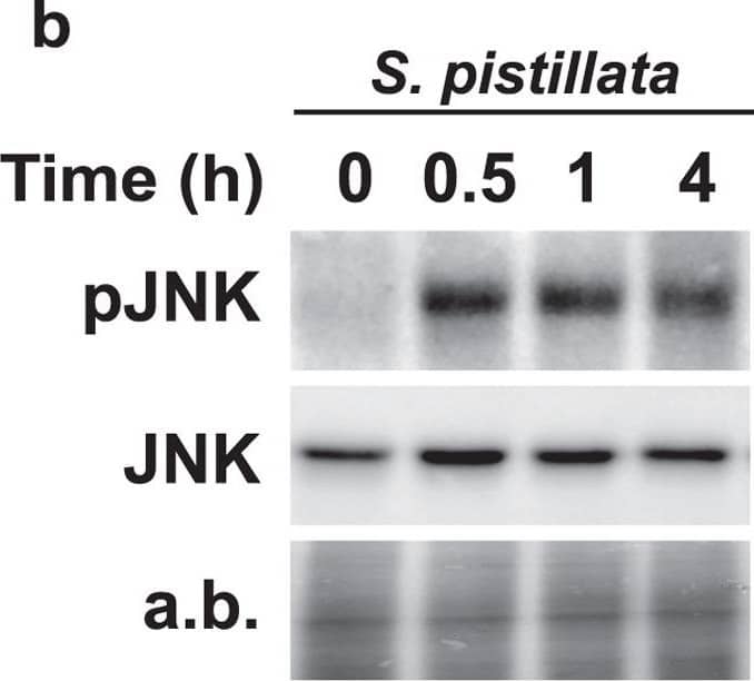 Time course of JNK activation by combined UVR and thermal stresses in human fibroblasts and coral.Immunoblot revealing activated (pJNK) and total JNK (JNK) in (a) human fibroblasts or (b) S. pistillata nubbins exposed to UVR and temperature rise for the indicated times. (a) Total JNK and actin served as loading controls for human fibroblasts. (b) Total JNK and amido black staining (a,b) served as loading controls for S. pistillata. Data are representative of three independent experiments. Image collected and cropped by CiteAb from the following open publication (//pubmed.ncbi.nlm.nih.gov/28374828), licensed under a CC-BY license. Not internally tested by R&D Systems.