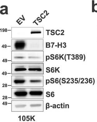 B7-H3 expression is regulated by mTORC1.B7-H3 protein expression in Tsc2−/− 105K cells with stable reconstitution of TSC2 or empty vector (EV) (a), TSC2−/− 621-101 angiomyolipoma-derived cells with reconstitution of TSC2 or empty vector (EV) (b), and Tsc2-WT and Tsc2 KO MEFs (c). For all figure legends, n = 3 indicates representative of 3 biologic samples (n = 3). B7-H3 mRNA expression in Tsc2−/− 105K cells with stable reconstitution of TSC2 or empty vector (EV) (d), TSC2−/− 621-101 angiomyolipoma tumor cells with reconstitution of TSC2 or empty vector (EV) (e), Tsc2-WT and Tsc2 KO MEFs (f). Means ± SD, two-tailed unpaired Student’s t-test (d, f) or one-way ANOVA with Dunnett’s multiple comparisons test (e), *p < 0.05, **p < 0.01. n = 3. B7-H3 protein expression in Tsc2−/− 105K cells (g), TSC2−/− 621-101 angiomyolipoma tumor cells (h), and Tsc2 KO MEFs (i) treated with 20 nM rapamycin (Rapa), 500 nM Torin 1 or vehicle for 24 hr (n = 3). B7-H3 mRNA expression in Tsc2−/− 105K cells (j), TSC2−/− 621-101 angiomyolipoma tumor cells (k), and Tsc2 KO MEFs (l) treated with 20 nM rapamycin (Rapa), 500 nM Torin 1, or vehicle for 24 hr. n = 3, means ± SD, one-way ANOVA with Dunnett’s multiple comparisons test, *p < 0.05, **p < 0.01, ***p < 0.001. m Immunoblotting analysis of Tsc2-WT and Tsc2 KO MEFs transfected with non-targeting control siRNA (Ctrl) or SMARTpool siRNAs targeting Raptor, Rictor, mTOR, S6K, or 4E-BP1 for 48 h hr (n = 3). n qRT-PCR analysis of Tsc2-WT and Tsc2 KO MEFs transfected with non-targeting control siRNA (Ctrl) or SMARTpool siRNAs targeting either Raptor, Rictor, mTOR, S6K, or 4E-BP1 for 48 hr. n = 3, means ± SD, two-way ANOVA with Dunnett’s multiple comparisons test, ***p < 0.001, ****p < 0.0001. Source data and exact p values are provided in the Source data file. Image collected and cropped by CiteAb from the following open publication (//pubmed.ncbi.nlm.nih.gov/36869048), licensed under a CC-BY license. Not internally tested by R&D Systems.