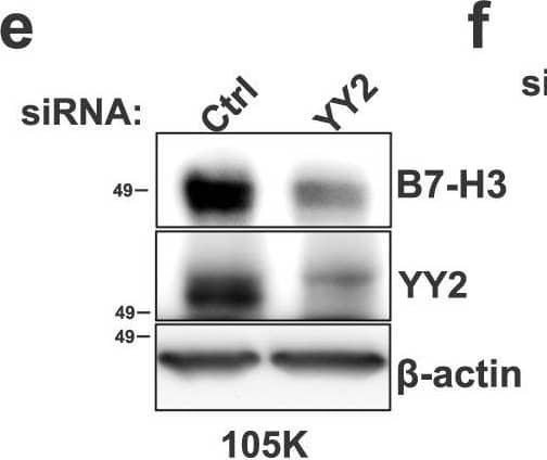 YY2 controls CD276 transcription in Tsc2-deficient cells. Enhanced Cd276 promoter activity in Tsc2−/− 105K cells expressing empty vector (EV) compared to reconstitution of TSC2 (a) and in Tsc2 KO MEFs compared to Tsc2-WT MEFs (b). Relative luciferase activity was determined by a dual-luciferase assay system. psiCHECK2-Cd276 encodes the Cd276 promoter. Empty psiCHECK2 vector was used as the negative control. n = 6, means ± SD, two-way ANOVA with Holm-Sidak’s multiple comparisons test, *p < 0.05, ***p < 0.001. Raptor, mTOR or S6K knockdown suppresses Cd276 promoter activity in Tsc2−/− 105K cells (c) and Tsc2 KO MEFs (d). n = 6, means ± SD, two-way ANOVA with Holm-Sidak’s multiple comparisons test, *p < 0.05, **p < 0.01, ****p < 0.0001. siRNA knockdown of YY2 reduces B7-H3 protein expression in Tsc2−/− 105K cells (e) and Tsc2 KO MEFs (f) (n = 3). Knockdown of YY2 reduces Cd276 mRNA expression in Tsc2−/− 105K cells (g) and Tsc2 KO MEFs (h). n = 3, means ± SD, two-tailed unpaired Student’s t-test, *p < 0.05, ***p < 0.001. i Promoter region of Cd276 displaying the location of the YY2 binding site. YY2 ChIP-qPCR analysis showing increased YY2 occupancy on the Cd276 promoter in Tsc2−/− 105K cells (j) and Tsc2 KO MEFs (k). n = 4, means ± SEM, two-way ANOVA with Holm-Sidak’s multiple comparisons test, *p < 0.05, **p < 0.01, ****p < 0.0001. Cd276 promoter activity is suppressed by YY2 knockdown in Tsc2−/− 105K cells (l) and Tsc2 KO MEFs (m). n = 6, means ± SD, two-way ANOVA with Holm-Sidak’s multiple comparisons test, *p < 0.05, ***p < 0.001. Source data and exact p values are provided in the Source data file. Image collected and cropped by CiteAb from the following open publication (//pubmed.ncbi.nlm.nih.gov/36869048), licensed under a CC-BY license. Not internally tested by R&D Systems.