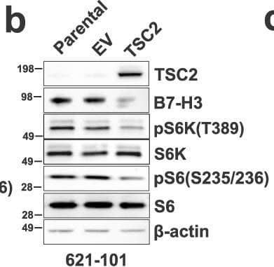 B7-H3 expression is regulated by mTORC1.B7-H3 protein expression in Tsc2−/− 105K cells with stable reconstitution of TSC2 or empty vector (EV) (a), TSC2−/− 621-101 angiomyolipoma-derived cells with reconstitution of TSC2 or empty vector (EV) (b), and Tsc2-WT and Tsc2 KO MEFs (c). For all figure legends, n = 3 indicates representative of 3 biologic samples (n = 3). B7-H3 mRNA expression in Tsc2−/− 105K cells with stable reconstitution of TSC2 or empty vector (EV) (d), TSC2−/− 621-101 angiomyolipoma tumor cells with reconstitution of TSC2 or empty vector (EV) (e), Tsc2-WT and Tsc2 KO MEFs (f). Means ± SD, two-tailed unpaired Student’s t-test (d, f) or one-way ANOVA with Dunnett’s multiple comparisons test (e), *p < 0.05, **p < 0.01. n = 3. B7-H3 protein expression in Tsc2−/− 105K cells (g), TSC2−/− 621-101 angiomyolipoma tumor cells (h), and Tsc2 KO MEFs (i) treated with 20 nM rapamycin (Rapa), 500 nM Torin 1 or vehicle for 24 hr (n = 3). B7-H3 mRNA expression in Tsc2−/− 105K cells (j), TSC2−/− 621-101 angiomyolipoma tumor cells (k), and Tsc2 KO MEFs (l) treated with 20 nM rapamycin (Rapa), 500 nM Torin 1, or vehicle for 24 hr. n = 3, means ± SD, one-way ANOVA with Dunnett’s multiple comparisons test, *p < 0.05, **p < 0.01, ***p < 0.001. m Immunoblotting analysis of Tsc2-WT and Tsc2 KO MEFs transfected with non-targeting control siRNA (Ctrl) or SMARTpool siRNAs targeting Raptor, Rictor, mTOR, S6K, or 4E-BP1 for 48 h hr (n = 3). n qRT-PCR analysis of Tsc2-WT and Tsc2 KO MEFs transfected with non-targeting control siRNA (Ctrl) or SMARTpool siRNAs targeting either Raptor, Rictor, mTOR, S6K, or 4E-BP1 for 48 hr. n = 3, means ± SD, two-way ANOVA with Dunnett’s multiple comparisons test, ***p < 0.001, ****p < 0.0001. Source data and exact p values are provided in the Source data file. Image collected and cropped by CiteAb from the following open publication (//pubmed.ncbi.nlm.nih.gov/36869048), licensed under a CC-BY license. Not internally tested by R&D Systems.