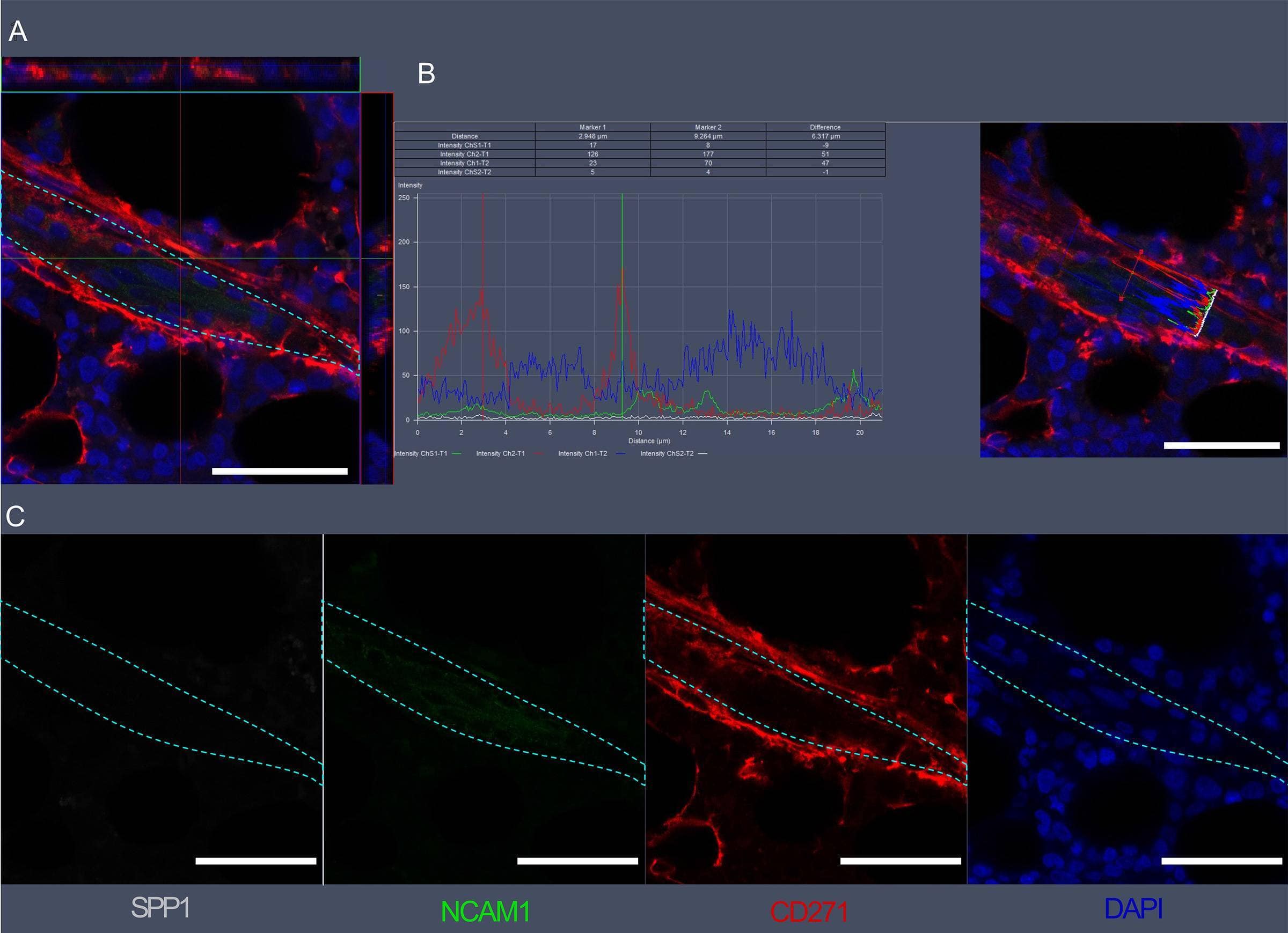 Visualization of SPP1, NCAM1, and CD271 expression in bone marrow vascular regions by confocal microscopy.(A) Confocal scan of vascular region in BM biopsies with 3D orthographic cross-section view, co-stained with rabbit anti-NCAM1, mouse anti-CD271, goat anti-SPP1, and DAPI. (B) Intensity profile for all channels in A across a cell of interest in a representative z plane. (C) Single channel data for the florescent markers in A. Scale bars represent 50 μm. Cyan dashed lines indicate vessel surface. Image collected and cropped by CiteAb from the following open publication (//pubmed.ncbi.nlm.nih.gov/36876630), licensed under a CC-BY license. Not internally tested by R&D Systems.