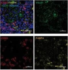 Pancreatic TRM cell recruitment during T1D progression is FABP4‐dependent. G) Representative images of immunofluorescent co‐staining of FABP4, CD69,&insulin in the pancreas of 10‐week‐old NOD mice (Scale bar 20 µm). Image collected & cropped by CiteAb from the following open publication (//pubmed.ncbi.nlm.nih.gov/38884133), licensed under a CC-BY license. Not internally tested by R&D Systems.