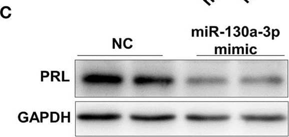 Western Blot Prolactin Antibody [Unconjugated]