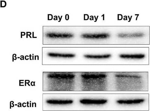 Western Blot Prolactin Antibody [Unconjugated]