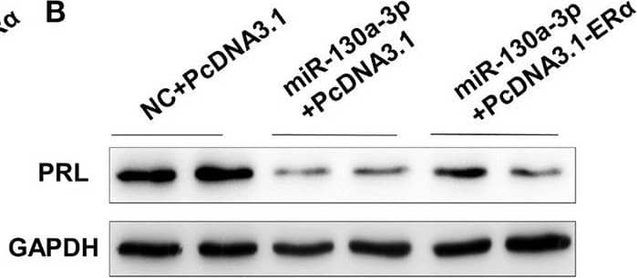 Western Blot Prolactin Antibody [Unconjugated]