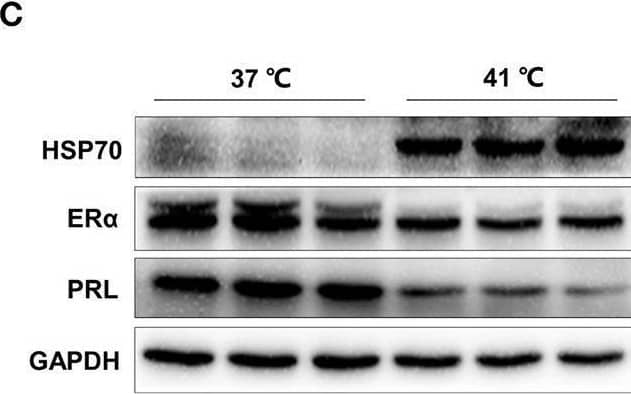 Western Blot Prolactin Antibody [Unconjugated]