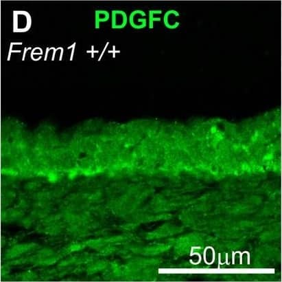 FREM1 regulates activation of AKT and MAPK upon PDGFC stimulation. (A) Representative western blotting of phosphorylation of AKT and MAPK ERK1/2 in MEFs from WT and bat mouse embryos stimulated with PDGFCC for the indicated time periods. (B) Relative quantification of AKT phosphorylation levels. WT cells 10 minutes after stimulation were assigned a value of 1 and all other samples are standardised against this value. Graph represents average of up to nine WT and 16 bat samples, performed across four independent experiments from at least three different cell lines for each genotype. Black bars: WT; white bars, bat mutant. (C) FREM1 mutation in bat mutants reduces phosphorylation of PDGFR alpha  in response to the addition of exogenous PDGFCC. IP, immunoprecipitation antibody; WB, western blotting antibody. (D) E13.5 WT embryo head skin sections stained for PDGFC (green), PDGFR alpha  (red) and nuclear dye DAPI (blue). Error bars represent standard error of the mean (s.e.m.); *P<0.05, **P<0.01, ***P<0.005. Image collected and cropped by CiteAb from the following open publication (//pubmed.ncbi.nlm.nih.gov/24046351), licensed under a CC-BY license. Not internally tested by R&D Systems.