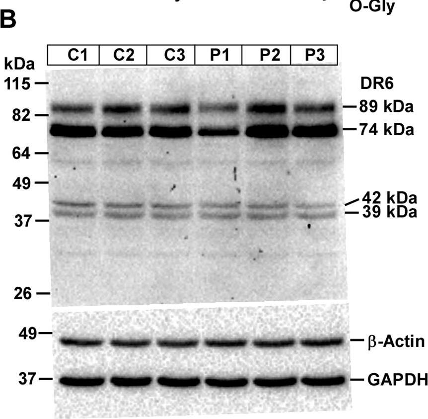 Western Blot DR6/TNFRSF21 Antibody