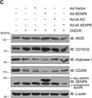 Inhibition of SENP6 promoted microglial polarization towards an anti-inflammatory phenotype after OGD/R treatment. A, B Primary cultured microglia were infected with adenovirus expressing wild-type SENP6 or shRNA against SENP6 following OGD/R treatment. The mRNA levels of OGD/R-induced proinflammatory (A) and anti-inflammatory (B) phenotype marker genes were detected by RT–qPCR. C Immunoblots showing the protein expression of iNOS, CD16/32, Arginase-1 and CD206 in primary microglia infected with Ad-SENP6 or Ad-sh. SENP6. D–G Quantification analysis of the protein levels in C. H–M The supernatant of primary microglia was collected, and cytokine levels were detected by ELISA. Data are presented as the mean ± S.E.M. from at least three dependent experiments and analysed by one-way ANOVA followed by Tukey’s post-hoc test. ns for P > 0.05, *P  0.05, *P < 0.05, **P < 0.01, ***P < 0.001, and ****P < 0.0001 Image collected and cropped by CiteAb from the following open publication (//pubmed.ncbi.nlm.nih.gov/35869493), licensed under a CC-BY license. Not internally tested by R&D Systems.