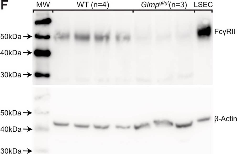 Fc gamma RIIb expression in liver from Glmpgt/gt and WT mice. A-B) Fc gamma RII expression in liver sinusoids of A) 4 months old, and B) 9–10 months old Glmpgt/gt and WT male mice. In WT livers, positive immunostaining (red fluorescence) was seen along the sinusoids in the same cells that had taken up FITC-FSA (green fluorescence), while the expression was low or absent in Glmpgt/gt livers, including cells that had taken up FITC-FSA (arrows). Nuclei in A) are stained with DAPI (blue). Scale bars: 20 μm. C) Quantitative image analysis of Fc gamma RII staining (% positive area) in liver sections from WT and Glmpgt/gt mice. Groups: Young WT, 3–6 months (n = 5); young Glmpgt/gt, 4 months (n = 5); old WT, 9–10 months (n = 4), and old Glmpgt/gt, 9–10 months (n = 6). Each dot represents one animal. Medians are presented as horizontal lines, and upper and lower lines represent interquartile range. *p-value < 0.05, **p-value < 0.01, One-way non-parametric ANOVA on ranks (Kruskal-Wallis test). D) Fcgr2b expression (qPCR) in liver tissue from 4 months (“young”) and 9 months (“old”) WT and Glmpgt/gt male mice (young: n = 4 per group; old: n = 3 per group). *p-value < 0.05 (Mann Whitney U test). Error bars represent standard deviation. E, F) Western blots showing Fc gamma RII expression in whole liver lysates from E) 4 WT mice and 3 Glmpgt/gt mice, aged 4 months, and F) 4 WT mice and 3 Glmpgt/gt mice, aged 9 months, all male. LSEC: Mouse liver sinusoidal endothelial cell lysates (C57Bl/6JRj, WT). Protein loaded per lane: Liver lysates, 25 μg; LSEC, 5 μg. Beta-actin loading control was performed on the stripped blots. Image collected and cropped by CiteAb from the following open publication (//pubmed.ncbi.nlm.nih.gov/37910485), licensed under a CC-BY license. Not internally tested by R&D Systems.
