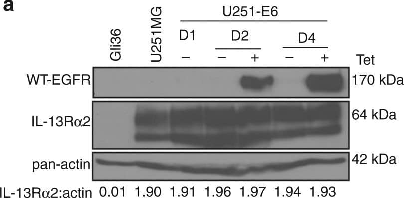Western Blot IL-13R alpha 2 Antibody [Unconjugated]