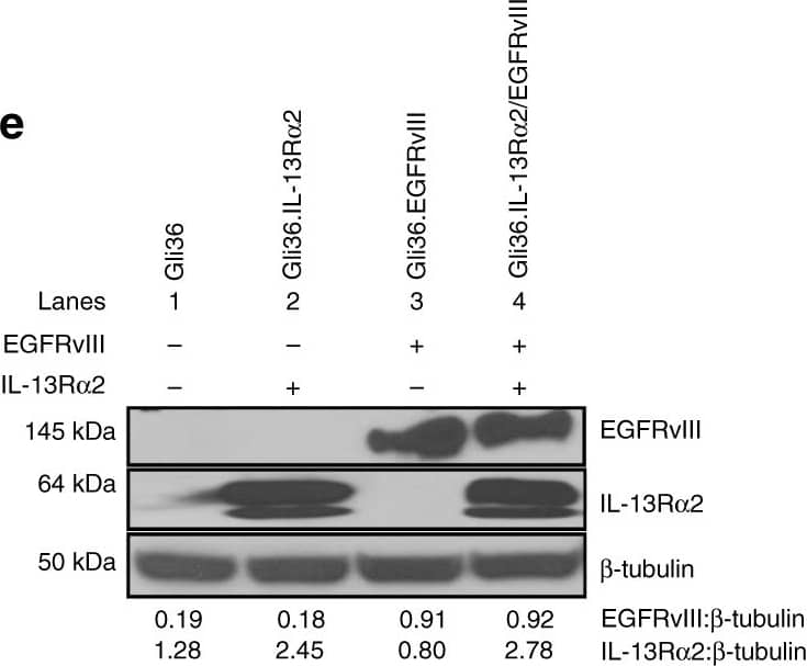 Western Blot IL-13R alpha 2 Antibody [Unconjugated]