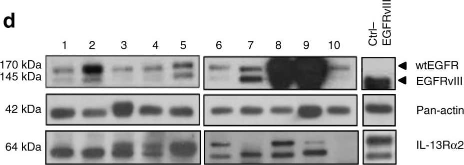 Western Blot IL-13R alpha 2 Antibody [Unconjugated]