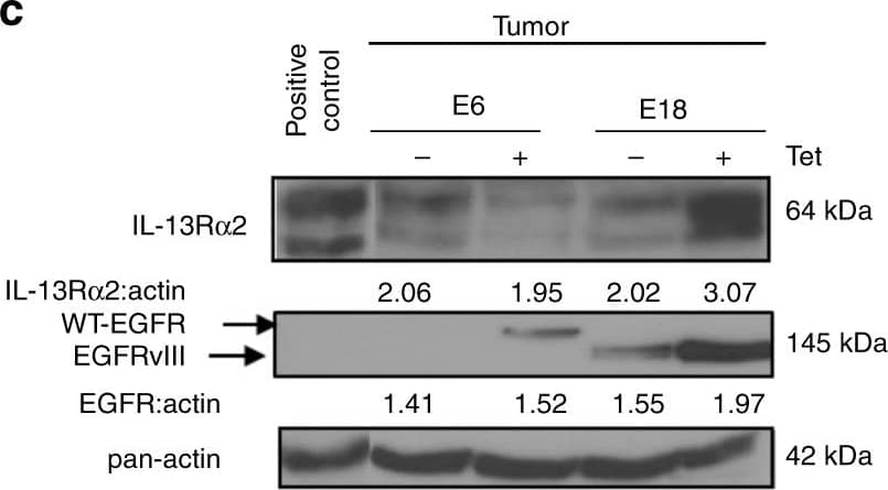 Western Blot IL-13R alpha 2 Antibody [Unconjugated]