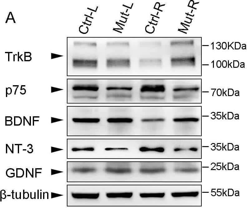 Expression profile of neurotrophic factors and receptors 7 days post surgery.Seven days post surgery, injured (R) and intact (L) sides of C5–C7 segments were collected separately for Western blot with anti- TrkB, p75, BDNF, NT-3 and GDNF antibodies in control (Ctrl) and Celsr3|Emx1 (Mut) mice, and  beta -tubulin was used as a control protein (A). The expression level of each protein was normalized to beta -tubulin (B). Comparisons were summarized in C. In control mices, the expression of TrkB and BDNF was significantly decreased, but that of p75 was significantly increased, on injured sides (R) compared to intact sides (L). There was not significant difference in expression of neurotrophic factors and receptors between injured and intact sides in mutant mice. On both sides, the expression level of p75 was significantly lower in the mutant than in the control. On injured sides, the expression of TrkB and BDNF was significantly higher in the mutant than in the control although their expression was comparable on intact sides between two groups. “↓”, lower or decreased expression; “↑”, higher or increased expression; “_”, no significant difference; *, P<0.05; **, P<0.01; Ctrl-L, left side of control mice; Ctrl-R, right side of control mice; Mut-L, left side of mutant mice; Mut-R, right side of mutant mice. Six animals were used in each group and t-test was used for comparisons. Image collected and cropped by CiteAb from the following open publication (//pubmed.ncbi.nlm.nih.gov/25003601), licensed under a CC-BY license. Not internally tested by R&D Systems.