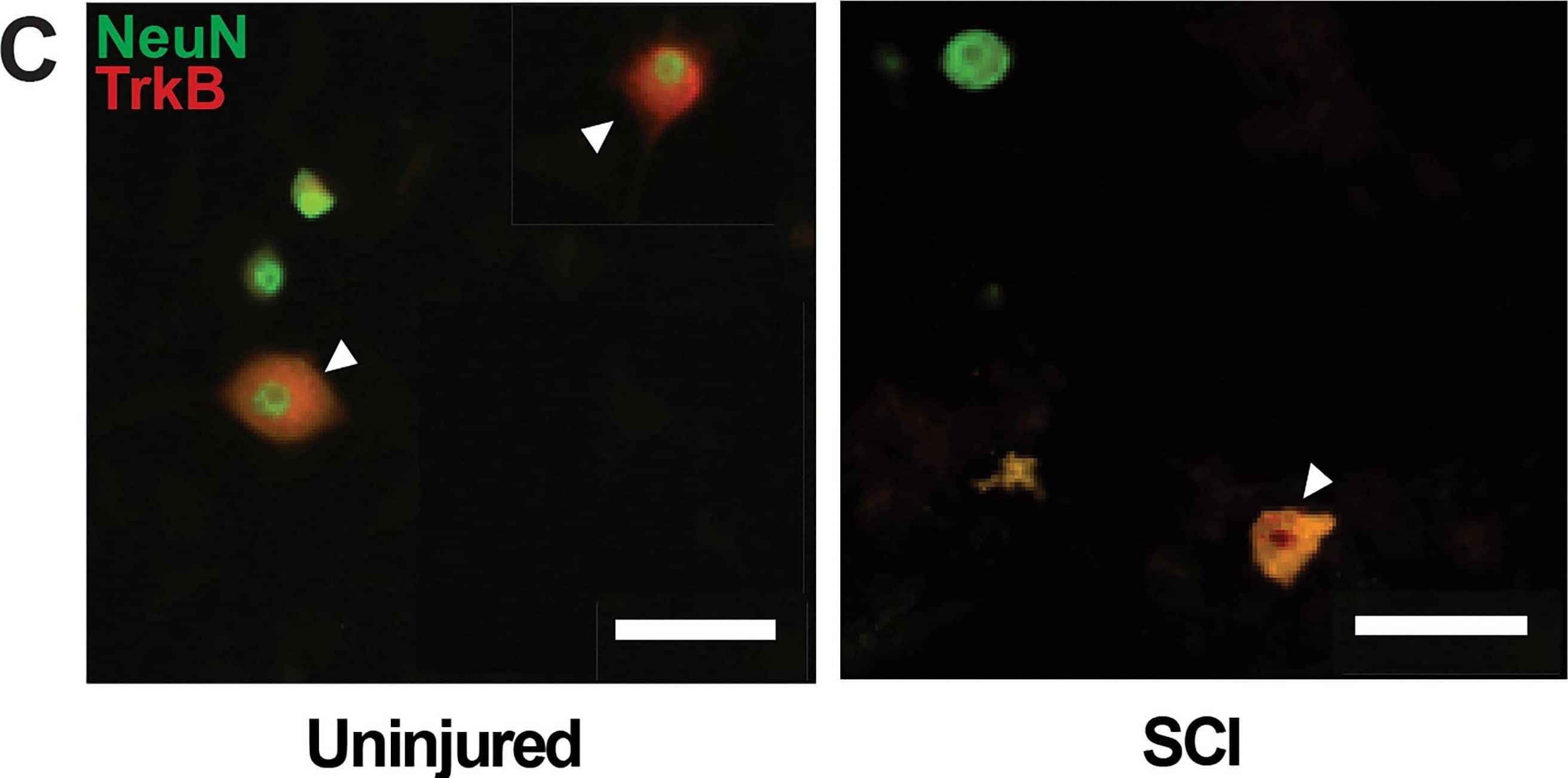 Immunocytochemistry/ Immunofluorescence TrkB Antibody [Unconjugated]