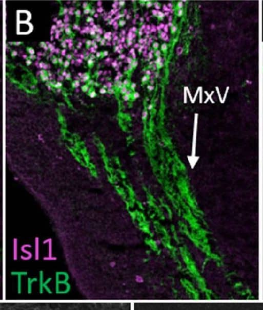 Immunohistochemistry TrkB Antibody [Unconjugated]
