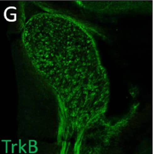 Immunohistochemistry TrkB Antibody [Unconjugated]