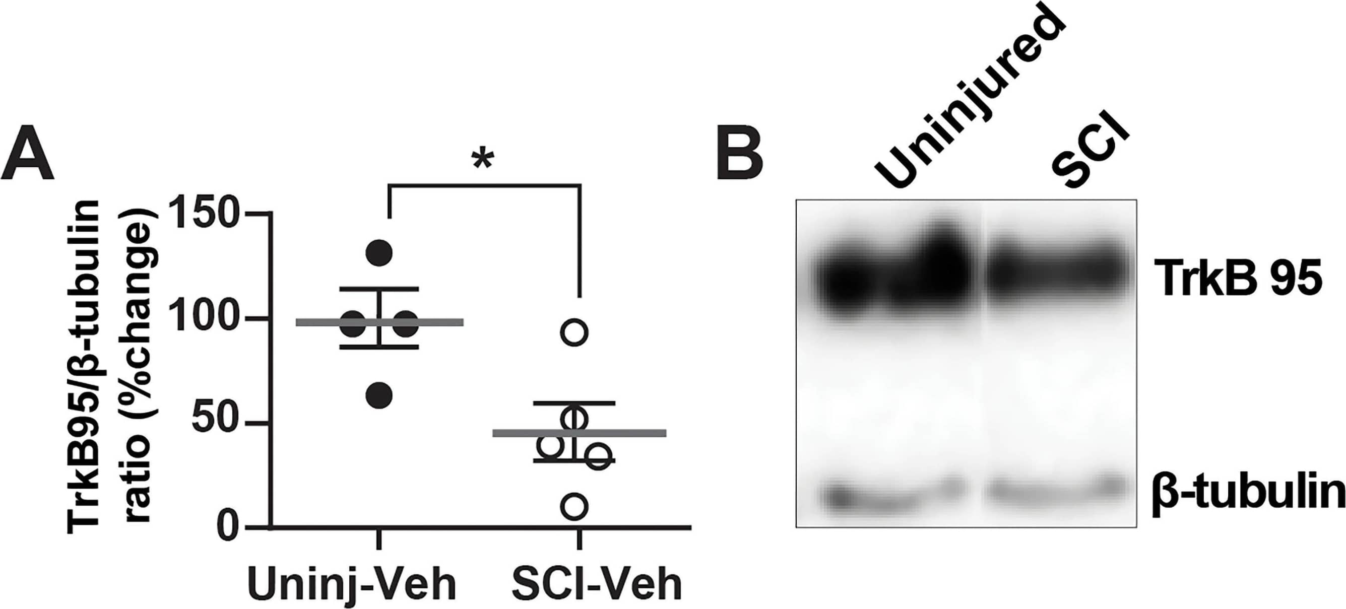 Western Blot TrkB Antibody [Unconjugated]