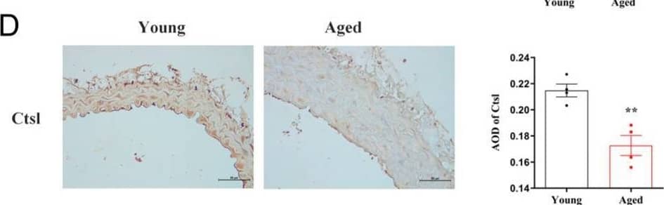 Ctsl expression is decreased in senescent aorta. (A) Representative images of hematoxylin-eosin staining in the thoracic aortas of aged (18-month-old) and young (8-week-old) mice (scale bar = 200 μm in top and 50 μm in bottom, respectively). (B) Representative images of Masson’s trichrome stain in the thoracic aortas (blue-gray staining for the collagens, scale bar = 200 μm in top and 50 μm in bottom, respectively). (C) Quantification of media thickness (MT), the ratio of media thickness to lumen diameter (MT/LD), media area (MA), and the ratio of collagen to media area (collagen/MA) using hematoxylin-eosin staining and Masson’s trichrome stain (n = 4). (D). Immunohistochemistry of Ctsl in the thoracic aortas of aged and young mice (brown staining for Ctsl, scale bar = 50 μm, n = 4). (E) Western Blot of Ctsl and p21 in young and senescent aortas (n = 3–4). Data were presented as mean ± SEM. T-test was used. * p < 0.05 vs. young, ** p < 0.01 vs. young, *** p < 0.001 vs. young. Image collected and cropped by CiteAb from the following open publication (//pubmed.ncbi.nlm.nih.gov/36671735), licensed under a CC-BY license. Not internally tested by R&D Systems.