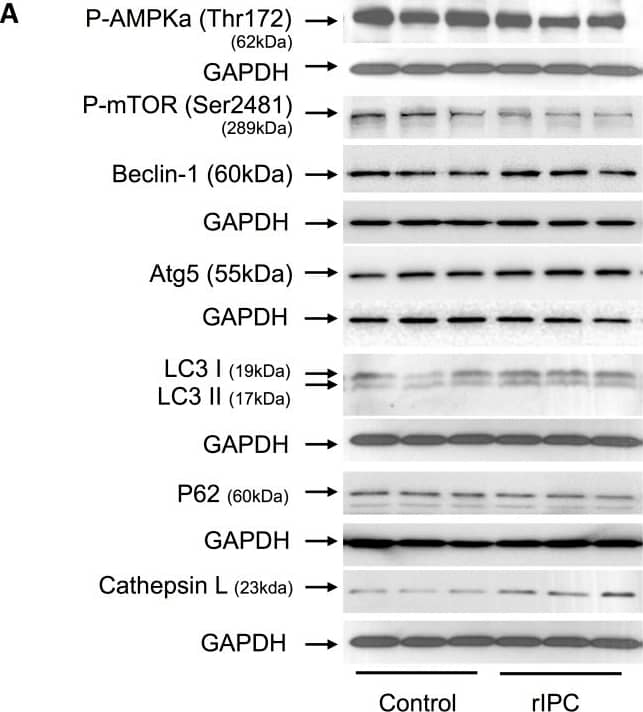Chronic, third window RIC increases the expression of autophagosome proteins, LC3I/II and Atg5.(A) Western blots for autophagy related signaling proteins. (B) Quantification of the protein fold change in 3W RIC compared to 3W controls. Values are means ± S.E.M. n = 6–8 per group. An (*) denotes a statistically significant difference (P<0.05) compared to control. (P-: phospho-). Image collected and cropped by CiteAb from the following open publication (//pubmed.ncbi.nlm.nih.gov/25347774), licensed under a CC-BY license. Not internally tested by R&D Systems.