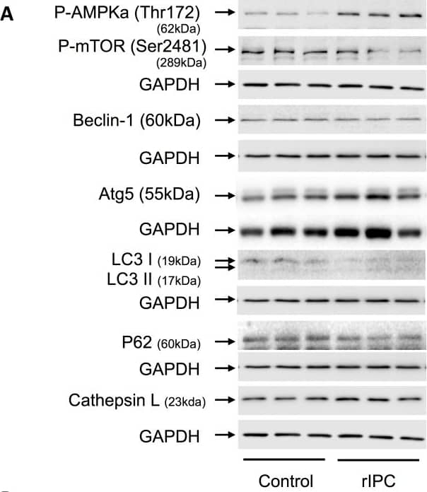 Acute, first window RIC activates autophagy signaling via p-AMPK upregulation and concomitant downregulation of mTOR.(A) Western blots for autophagy related signaling proteins. (B) Quantification of the protein fold change in 1W RIC compared to 1W controls. Values are means ± S.E.M. n = 6–8 per group. An (*) denotes a statistically significant difference (P<0.05) compared to control. (P-: phospho-). Image collected and cropped by CiteAb from the following open publication (//pubmed.ncbi.nlm.nih.gov/25347774), licensed under a CC-BY license. Not internally tested by R&D Systems.
