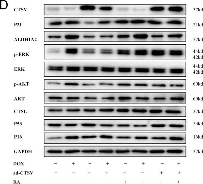 CTSV attenuates DOX-induced cellular senescence. (A). HUVECs were treated with ad-negative control (NC) or ad-CTSV (MOI = 10) for 8 h and simulated with 100 nM doxorubicin (DOX) and 1 μM RA for 24 h after incubated in complete growth medium for 40 h. SA-beta -gal activity was analyzed (blue staining for the senescent cells, scale bar = 50 μm, n = 4). (B) EdU assay of the cell proliferation ability in HUVECs treated with DOX, RA and ad-CTSV (red staining for the EdU, blue staining for Hoechst, scale bar = 25 μm, n = 4). (C) Representative image of the wound healing assay and the quantification of wound area in HUVECs (scale bar = 100 μm, n = 4). (D) Western blot of CTSV, ALDH1A2, P21, p-ERK1/2, ERK1/2, p-AKT, AKT, CTSL, P53, and P16 in HUVECs treated with DOX, RA and ad-CTSV (n = 4). (E) Relative mRNA level of CTSV, ALDH1A2, P21, IL-1 beta , IL-6, and ICAM-1 (n = 4). (F) RA concentration in HUVECs treated with DOX, RA, and ad-CTSV (n = 4). Data are presented as mean ± SEM. One-way ANOVA test was used. * p < 0.05, ** p < 0.01, *** p < 0.001. Image collected and cropped by CiteAb from the following open publication (//pubmed.ncbi.nlm.nih.gov/36671735), licensed under a CC-BY license. Not internally tested by R&D Systems.