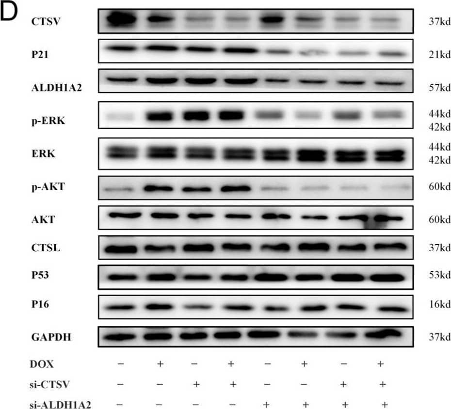Inhibition of CTSV induces cellular senescence. (A) HUVECs were treated with si-negative control (NC), si-CTSV, si-ALDH1A2 or si-CTSV + si-ALDH1A2 for 24 h and simulated with 100 nM doxorubicin (DOX) for 24 h after incubated in complete growth medium for 24 h. SA-beta -gal activity was analyzed (blue staining for the senescent cells, scale bar = 50 μm, n = 4). (B) EdU assay of the cell proliferation ability in HUVECs treated with DOX, si-CTSV and si-ALDH1A2 (red staining for the EdU, blue staining for Hoechst, scale bar = 25 μm, n = 4). (C) Representative image of the wound healing assay and the quantification of wound area in HUVECs (scale bar = 100 μm, n = 4). (D) Western blot of CTSV, ALDH1A2, P21, p-ERK1/2, ERK1/2, p-AKT, AKT, CTSL, P53 and P16 in HUVECs treated with DOX and siRNAs (n = 4). (E) Relative mRNA level of CTSV, ALDH1A2, P21, IL-1 beta , IL-6 and ICAM-1 (n = 4). (F) RA concentration in HUVECs treated with DOX and siRNAs (n = 4). Data are presented as mean ± SEM. One-way ANOVA test was used. * p < 0.05, ** p < 0.01, *** p < 0.001. Image collected and cropped by CiteAb from the following open publication (//pubmed.ncbi.nlm.nih.gov/36671735), licensed under a CC-BY license. Not internally tested by R&D Systems.